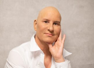 Co nosić na głowie po chemioterapii?